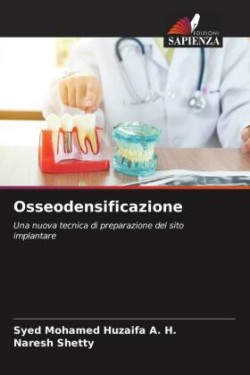 Osseodensificazione