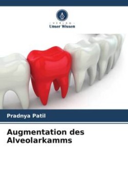 Augmentation des Alveolarkamms