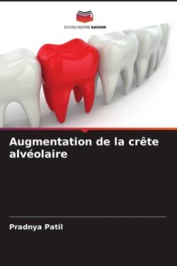 Augmentation de la crête alvéolaire