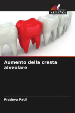 Aumento della cresta alveolare