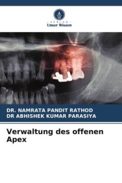 Verwaltung des offenen Apex