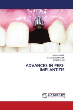 Advances in Peri-Implantitis