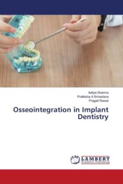 Osseointegration in Implant Dentistry