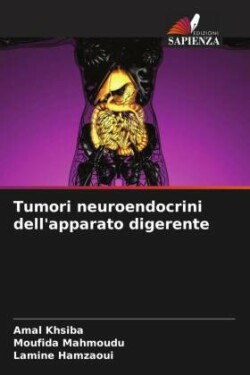 Tumori neuroendocrini dell'apparato digerente