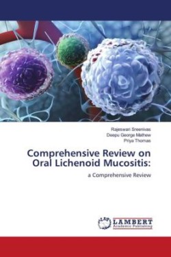 Comprehensive Review on Oral Lichenoid Mucositis