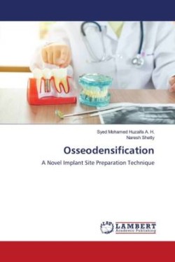 Osseodensification