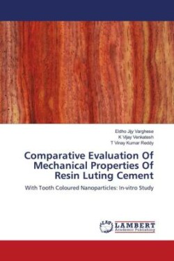 Comparative Evaluation Of Mechanical Properties Of Resin Luting Cement