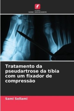 Tratamento da pseudartrose da tíbia com um fixador de compressão