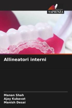 Allineatori interni