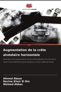 Augmentation de la crête alvéolaire horizontale