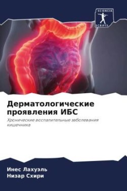 Дерматологические проявления ИБС