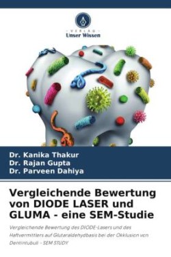 Vergleichende Bewertung von DIODE LASER und GLUMA - eine SEM-Studie