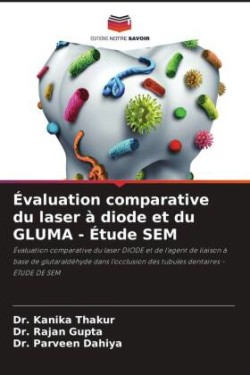 Évaluation comparative du laser à diode et du GLUMA - Étude SEM