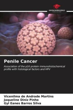 Penile Cancer