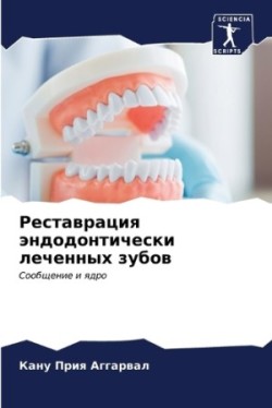 Реставрация эндодонтически леченных зуб&