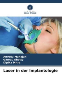 Laser in der Implantologie