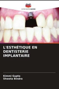 L'Esthétique En Dentisterie Implantaire