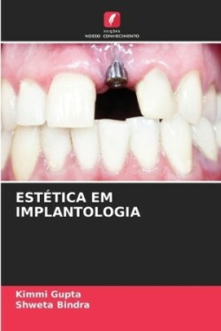 Estética Em Implantologia