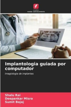 Implantologia guiada por computador