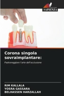 Corona singola sovraimplantare