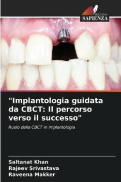 "Implantologia guidata da CBCT