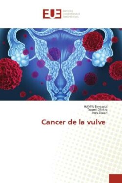 Cancer de la vulve