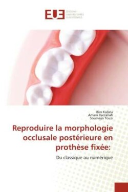 Reproduire la morphologie occlusale postérieure en prothèse fixée