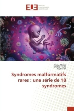 Syndromes malformatifs rares