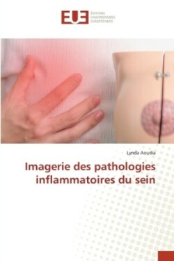 Imagerie des pathologies inflammatoires du sein