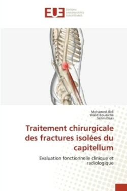 Traitement chirurgicale des fractures isolées du capitellum