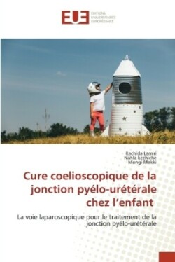 Cure coelioscopique de la jonction pyélo-urétérale chez l'enfant