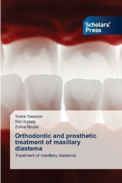 Orthodontic and prosthetic treatment of maxillary diastema