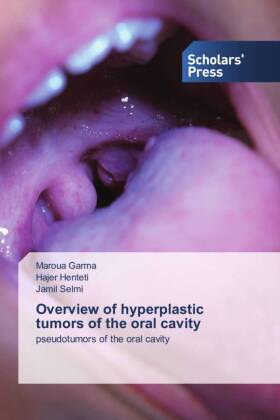 Overview of hyperplastic tumors of the oral cavity