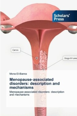 Menopause‐associated disorders