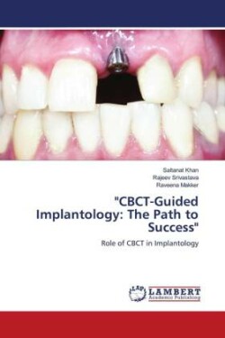 "CBCT-Guided Implantology: The Path to Success"