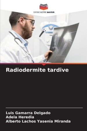 Radiodermite tardive