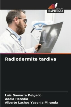 Radiodermite tardiva