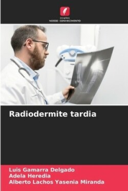 Radiodermite tardia