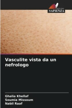 Vasculite vista da un nefrologo