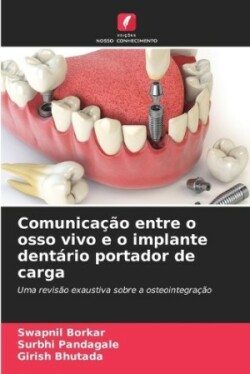 Comunicação entre o osso vivo e o implante dentário portador de carga