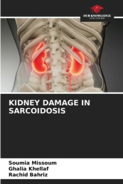 Kidney Damage in Sarcoidosis