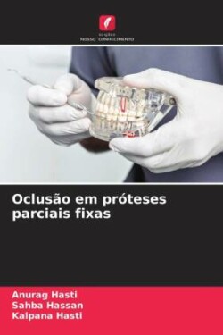 Oclusão em próteses parciais fixas