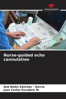 Nurse-guided echo cannulation