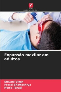 Expansão maxilar em adultos