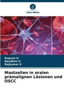 Mastzellen in oralen prämalignen Läsionen und OSCC