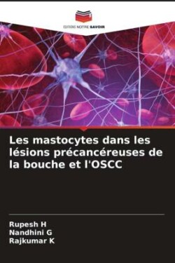 Les mastocytes dans les lésions précancéreuses de la bouche et l'OSCC