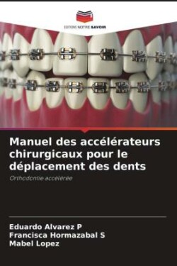 Manuel des accélérateurs chirurgicaux pour le déplacement des dents