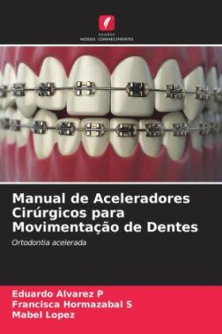 Manual de Aceleradores Cirúrgicos para Movimentação de Dentes