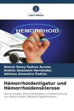 Hämorrhoidenligatur und Hämorrhoidensklerose