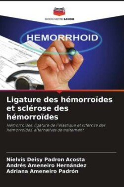 Ligature des hémorroïdes et sclérose des hémorroïdes